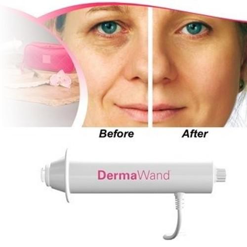 Derma Wand ránctalanító és pórustisztító készülék