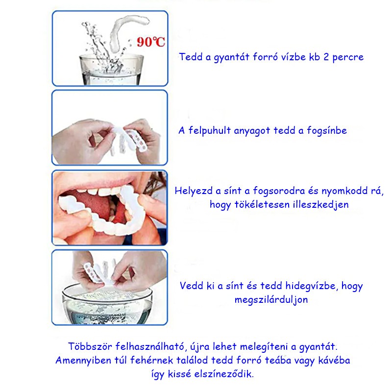 SNAP-ON SMILE, IDEIGLENES ALSÓ-FELSŐ KOZMETIKAI FOGHÍD