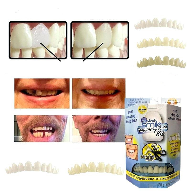 INSTANT SMILE KIT 30db ideiglenes fogpótló