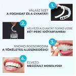 SNAP-ON SMILE, IDEIGLENES ALSÓ-FELSŐ KOZMETIKAI FOGHÍD